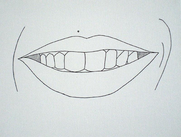 sourirebetty
